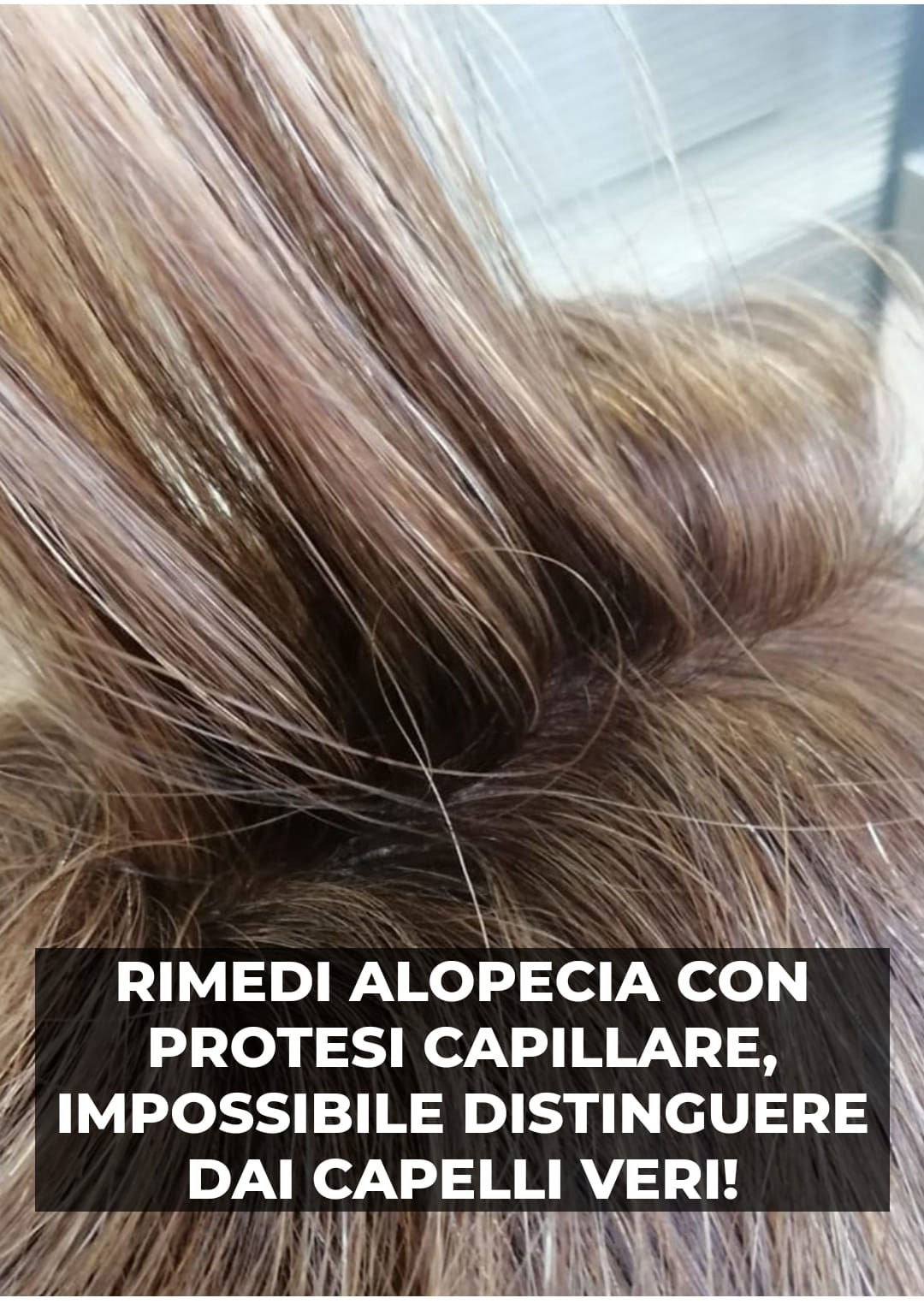 Soluzioni per calvizie e alopecia - protesi - Consulenza Soluzioni Alopecia Uomo Trofarello