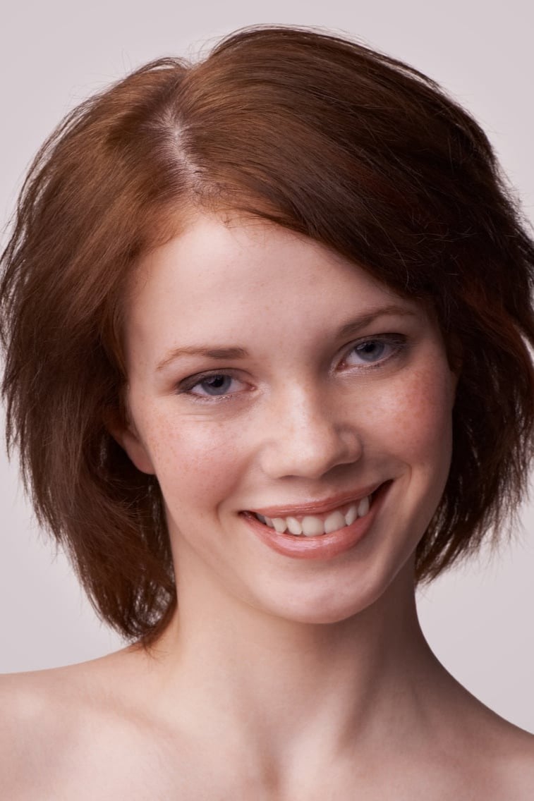 Soluzioni per calvizie e alopecia - protesi -  Capelli Finti 