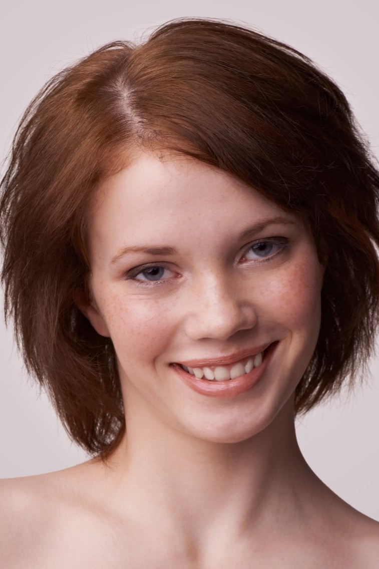 Soluzioni per calvizie e alopecia - protesi -   Murello